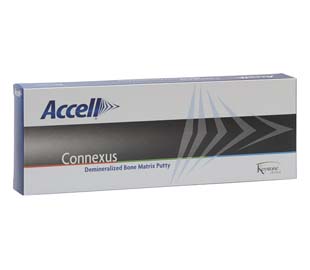1.0cc Accell Connexus DBM Bone Graft Substitute With BMPs