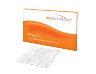 Mem-Lok Resorbable Collagen Membrane 30x40mm : 歯科材料の輸入通販:スマイルUS