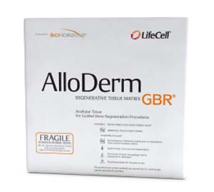 AlloDerm GBR 1x4cm