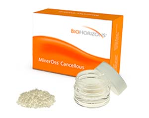 MinerOss FDBA Cancellous 2.5cc