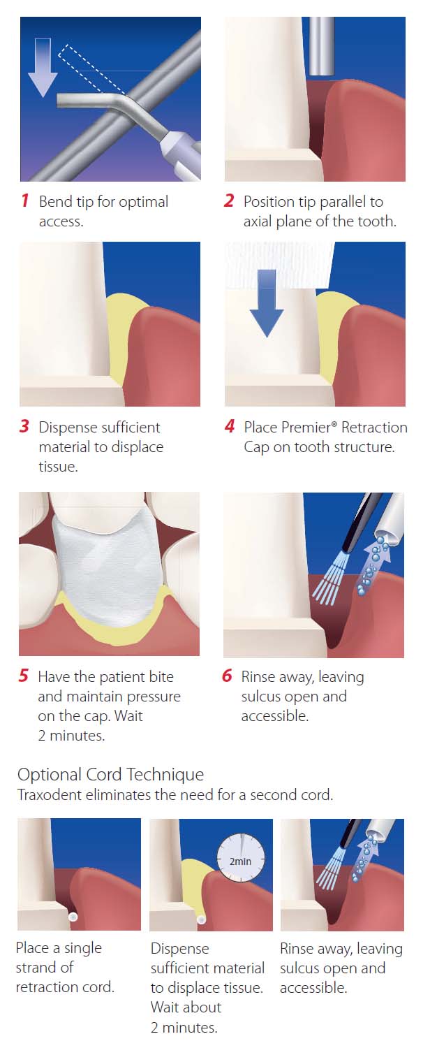 Traxodent 使用方法