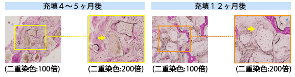症例写真2 症例写真2
